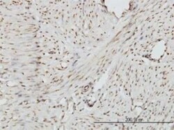 ZHX2 Antibody (5E2), Novus Biologicals 0.1 mg | Buy Online | Novus Biologicals | Fisher Scientific