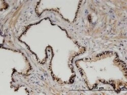 ZHX3 Antibody (1D9), Novus Biologicals 0.1 mg | Buy Online | Novus Biologicals | Fisher Scientific