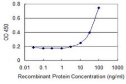 ZHX3 Antibody (1D9), Novus Biologicals 0.1 mg | Buy Online | Novus Biologicals | Fisher Scientific