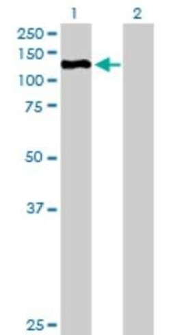 ZHX3 Antibody, Novus Biologicals 0.05 mg | Buy Online | Novus Biologicals | Fisher Scientific