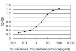 ZIC3 Antibody (2C1), Novus Biologicals 0.1 mg | Buy Online | Novus Biologicals | Fisher Scientific