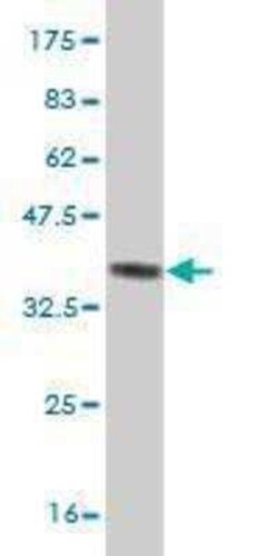 ZIC3 Antibody (2D3), Novus Biologicals 0.1 mg | Buy Online | Novus Biologicals | Fisher Scientific