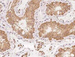 ZMAT1 Antibody, Novus Biologicals 50 &mu;g; Unconjugated:Antibodies, Polyclonal