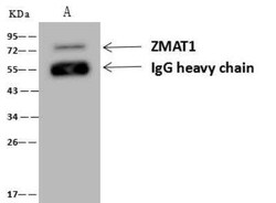 ZMAT1 Antibody, Novus Biologicals 50 &mu;g; Unconjugated:Antibodies, Polyclonal