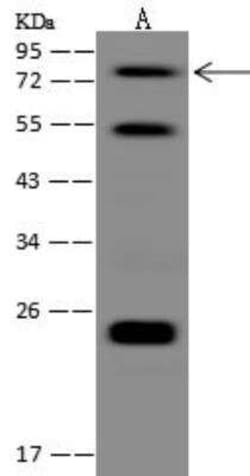 ZMAT1 Antibody, Novus Biologicals 50 &mu;g; Unconjugated:Antibodies, Polyclonal