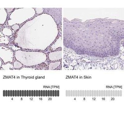 ZMAT4 Antibody, Novus Biologicals 25 &mu;L, Unconjugated:Antibodies, Polyclonal