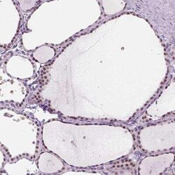 ZMAT4 Antibody, Novus Biologicals 25 &mu;L, Unconjugated:Antibodies, Polyclonal