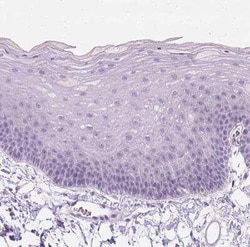 ZMAT4 Antibody, Novus Biologicals 25 &mu;L, Unconjugated:Antibodies, Polyclonal