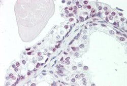 ZMYM6 Antibody, Novus Biologicals 100 &mu;L | Buy Online | Novus Biologicals | Fisher Scientific