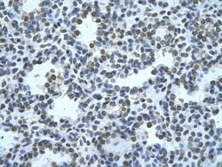ZMYND11 Antibody, Novus Biologicals 100 &mu;L; Unconjugated:Antibodies,