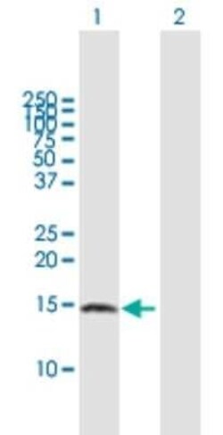 ZNDR1 Antibody, Novus Biologicals 0.05 mg | Buy Online | Novus Biologicals | Fisher Scientific