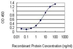 ZNF10 Antibody (1E1), Novus Biologicals 0.1 mg | Buy Online | Novus Biologicals | Fisher Scientific