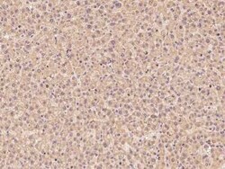 ZNF100 Antibody, Novus Biologicals:Antibodies:Primary Antibodies