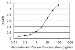 ZNF101 Antibody (2D5), Novus Biologicals 0.1 mg | Buy Online | Novus Biologicals | Fisher Scientific