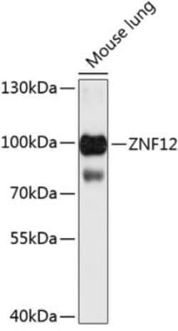 ZNF12 Antibody - BSA Free, Novus Biologicals 0.1 mL; Unconjugated:Antibodies,