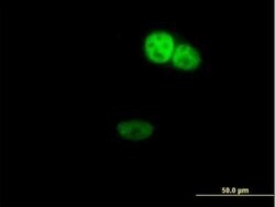 ZNF124 Antibody, Novus Biologicals 0.05 mg | Buy Online | Novus Biologicals | Fisher Scientific