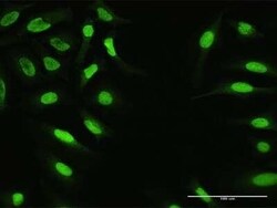 ZNF124 Antibody, Novus Biologicals 0.1 mg | Buy Online | Novus Biologicals | Fisher Scientific