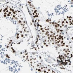 ZNF131 Antibody, Novus Biologicals 25 &mu;L, Unconjugated:Antibodies, Polyclonal