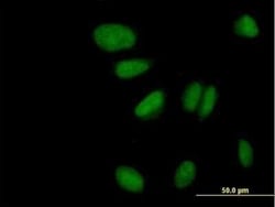 ZNF133 Antibody, Novus Biologicals 0.05 mg | Buy Online | Novus Biologicals | Fisher Scientific