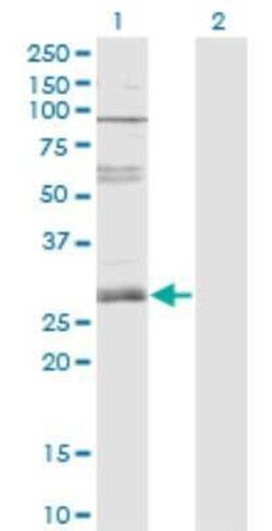ZNF138 Antibody (4D11), Novus Biologicals 0.1 mg | Buy Online | Novus Biologicals | Fisher Scientific