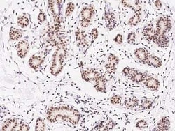 ZNF146 Antibody, Novus Biologicals:Antibodies:Primary Antibodies