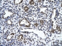 ZNF148 Antibody, Novus Biologicals 100 &mu;L; Unconjugated:Antibodies,