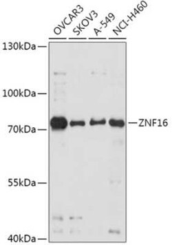 ZNF16 Antibody - Azide and BSA Free, Novus Biologicals 0.02 mL; Unconjugated:Antibodies,