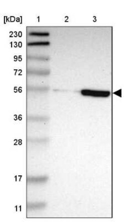 ZNF165 Antibody, Novus Biologicals 25 &mu;L, Unconjugated:Antibodies, Polyclonal