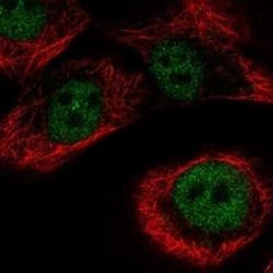 ZNF169 Rabbit anti-Human, Polyclonal, Novus Biologicals 25 &mu;g | Buy Online | Novus Biologicals | Fisher Scientific