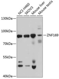 ZNF169 Antibody - BSA Free, Novus Biologicals:Antibodies:Primary Antibodies