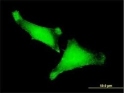 ZNF175 Antibody (1C2), Novus Biologicals 0.1 mg | Buy Online | Novus Biologicals | Fisher Scientific