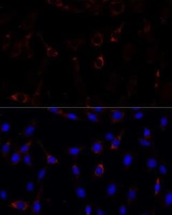 ZNF179 Antibody - Azide and BSA Free, Novus Biologicals:Antibodies:Primary