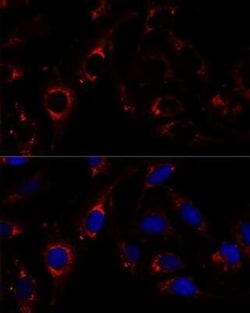 ZNF179 Antibody - Azide and BSA Free, Novus Biologicals:Antibodies:Primary