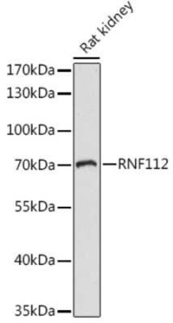 ZNF179 Antibody - Azide and BSA Free, Novus Biologicals:Antibodies:Primary