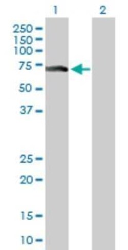 ZNF18 Antibody, Novus Biologicals 0.1 mg | Buy Online | Novus Biologicals | Fisher Scientific