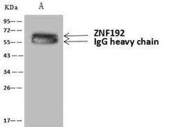 ZNF192 Antibody, Novus Biologicals 100 &mu;g; Unconjugated:Antibodies,