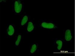 ZNF193 Antibody, Novus Biologicals 0.05 mg | Buy Online | Novus Biologicals | Fisher Scientific