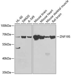 ZNF195 Antibody - BSA Free, Novus Biologicals 0.02 mL, Unconjugated:Antibodies,