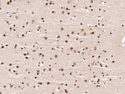 ZNF198 Antibody, Novus Biologicals:Antibodies:Primary Antibodies