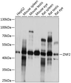 ZNF2 Antibody - BSA Free, Novus Biologicals 0.02 mL, Unconjugated:Antibodies,