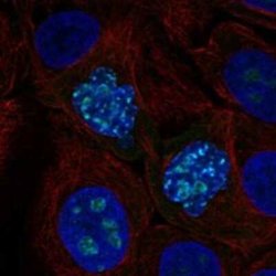 ZNF202 Rabbit anti-Human, Polyclonal, Novus Biologicals 25 &mu;g | Buy Online | Bio-Techne | Fisher Scientific