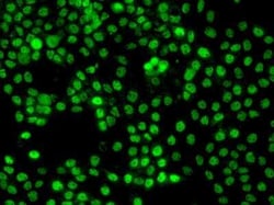 ZNF205 Antibody, Novus Biologicals 100 &mu;g; Unconjugated:Antibodies,
