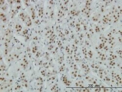 ZNF207 Antibody (6D7), Novus Biologicals 0.1 mg | Buy Online | Novus Biologicals | Fisher Scientific