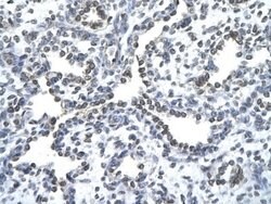 ZNF212 Antibody, Novus Biologicals 100 &mu;L; Unconjugated:Antibodies,