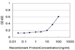ZNF215 Antibody (1E4), Novus Biologicals 0.1 mg | Buy Online | Novus Biologicals | Fisher Scientific