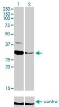 ZNF215 Antibody (2C11), Novus Biologicals 0.1 mg | Buy Online | Novus Biologicals | Fisher Scientific