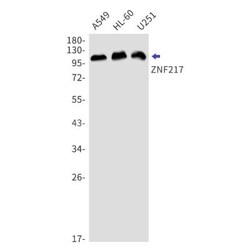 ZNF217 Antibody (S02-4B1), Novus Biologicals:Antibodies:Primary Antibodies