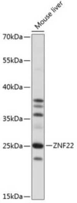 ZNF22 Antibody - Azide and BSA Free, Novus Biologicals:Antibodies:Primary