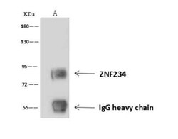 ZNF234 Antibody, Novus Biologicals 100 &mu;g; Unconjugated:Antibodies,