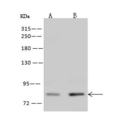 ZNF234 Antibody, Novus Biologicals 100 &mu;g; Unconjugated:Antibodies,